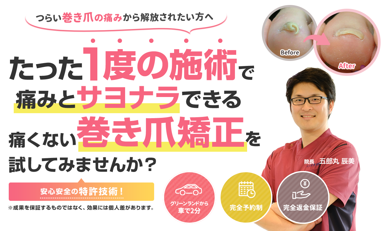 たった1度の施術で痛みとサヨナラできる痛くない巻き爪矯正を試してみませんか?