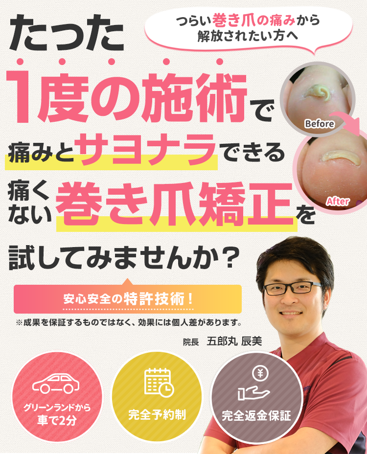 たった1度の施術で痛みとサヨナラできる痛くない巻き爪矯正を試してみませんか?